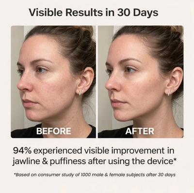 LumiLift Face And Neck Sculptor